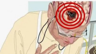 block-lvpdds0pssimg